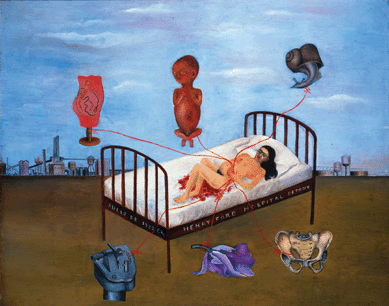 In the wake of a miscarriage in Detroit, Kahlo painted "Henry Ford Hospital,†1932, showing herself as a small, vulnerable figure lying on blood-soaked sheets in a bed surrounded by a vast plain and a desolate industrial skyline that create an impression of helplessness and loneliness. The large tear on her cheek, reflecting her suffering, is consistent with the weeping women motif of Mexican folklore. Collection Museo Delores Olmedo Patino, Mexico City.